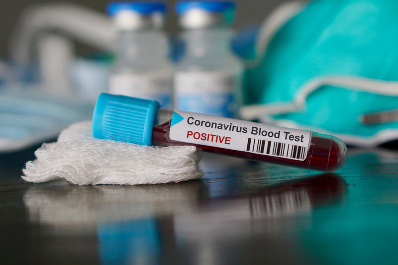 Tunisie/ Coronavirus : 61 nouveaux cas positifs, et 03 décès
