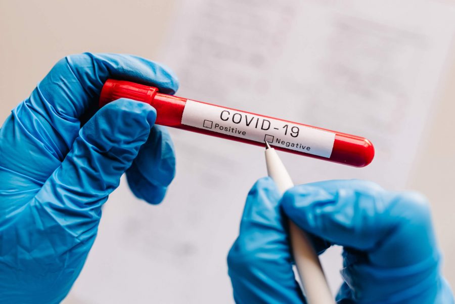 Coronavirus - test - dépistage